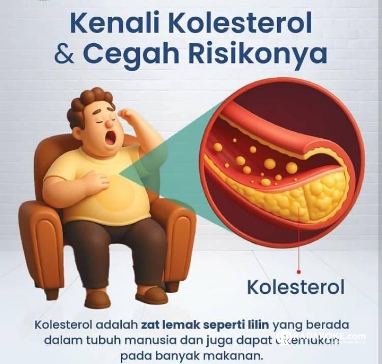 Waspada Kolesterol Tinggi Saat Makan Daging Idul Adha, Ini Gejalanya