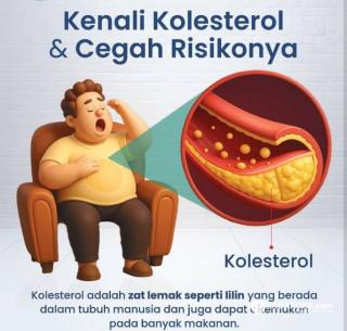 Waspada Kolesterol Tinggi Saat Makan Daging Idul Adha, Ini Gejalanya